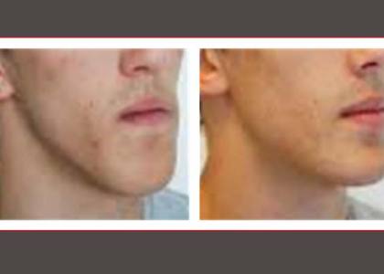 Stomatologie befelatanana